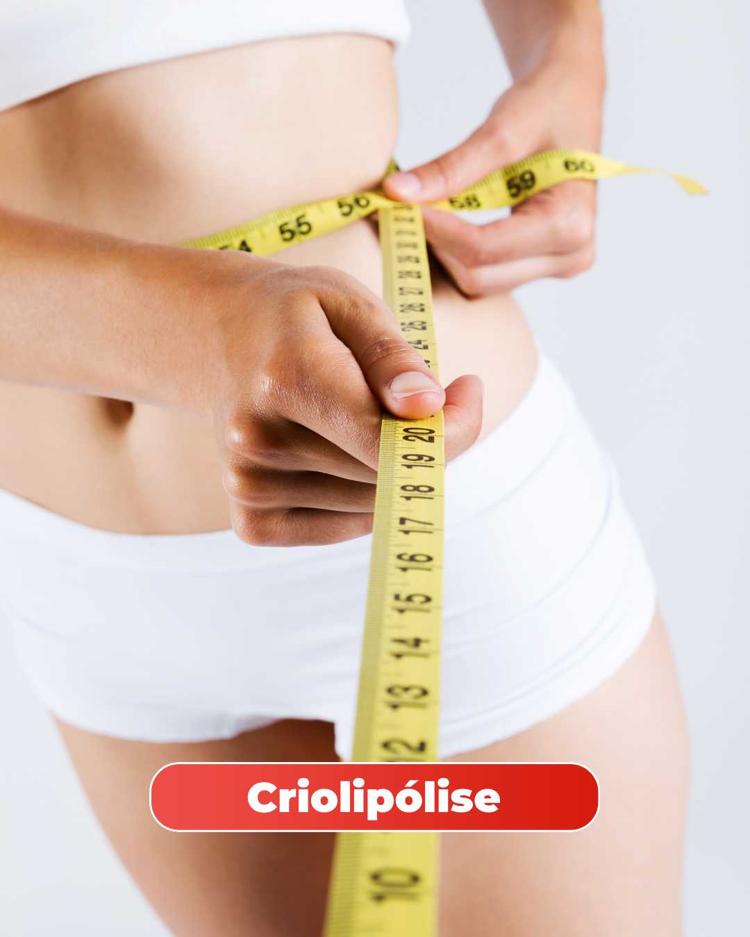 criolipolise na mitras estetica