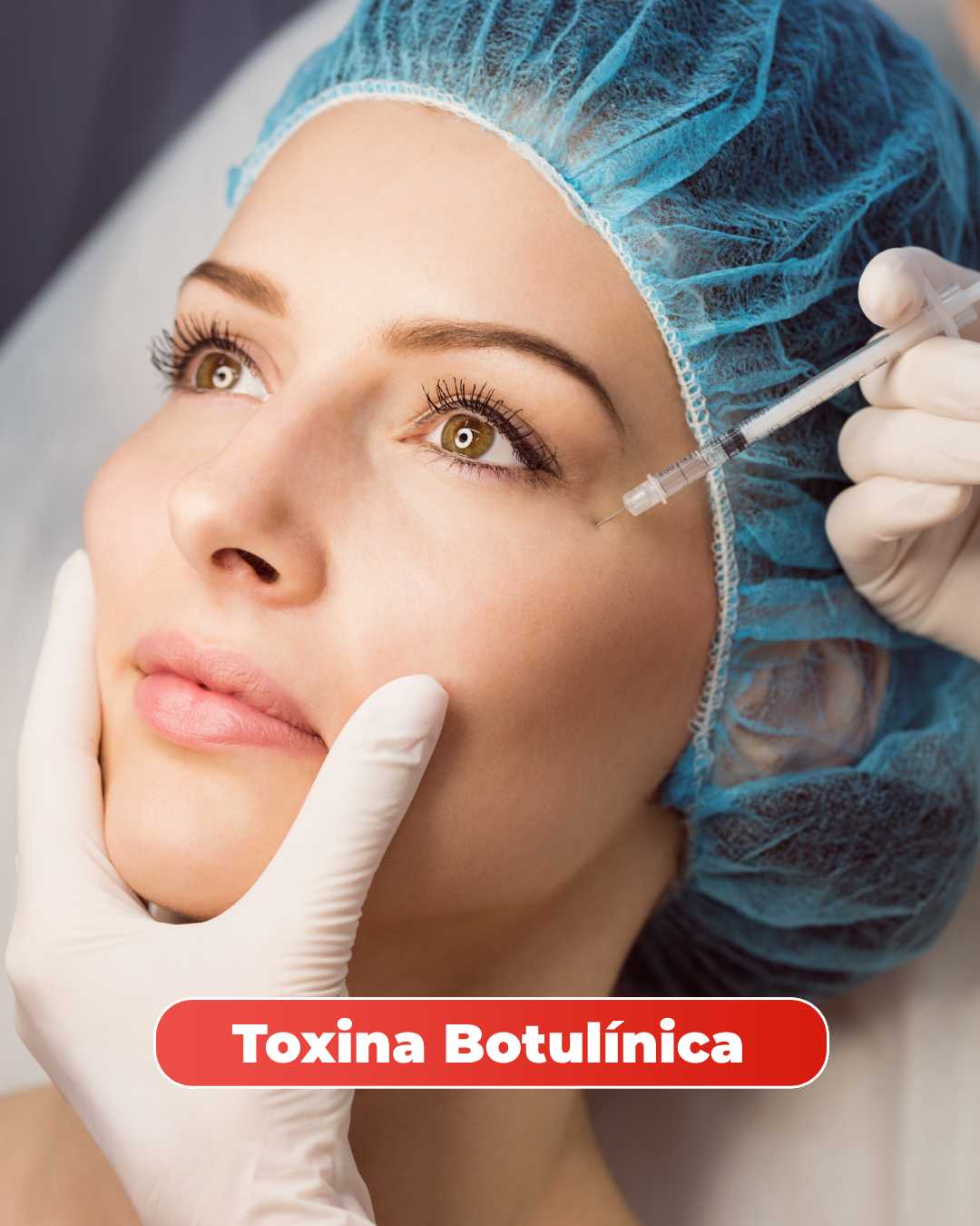 tratamento contra linhas de expressão e rugas