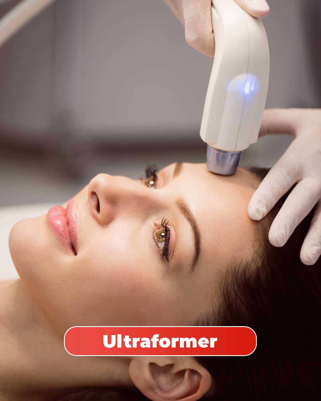 ultraformer facial na mitras estética